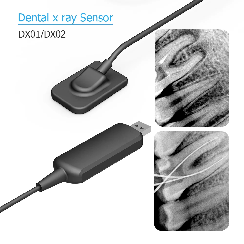 Sensor de raio x dental dynimage sistema intraoral digital de transmissão rápida intra-oral com software 3m cabo imagem clara dynimage