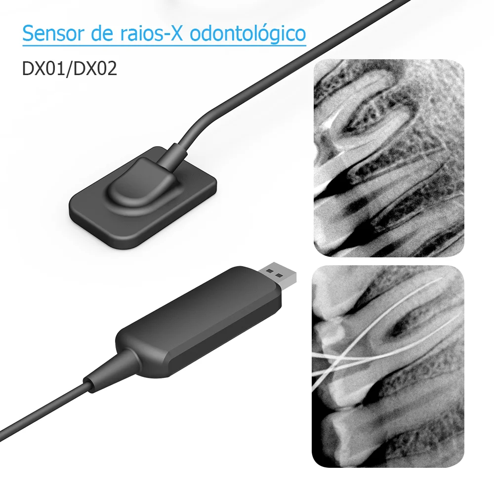 Sensor de raio x dental dynimage sistema intraoral digital de transmissão rápida intra-oral com software 3m cabo imagem clara dynimage