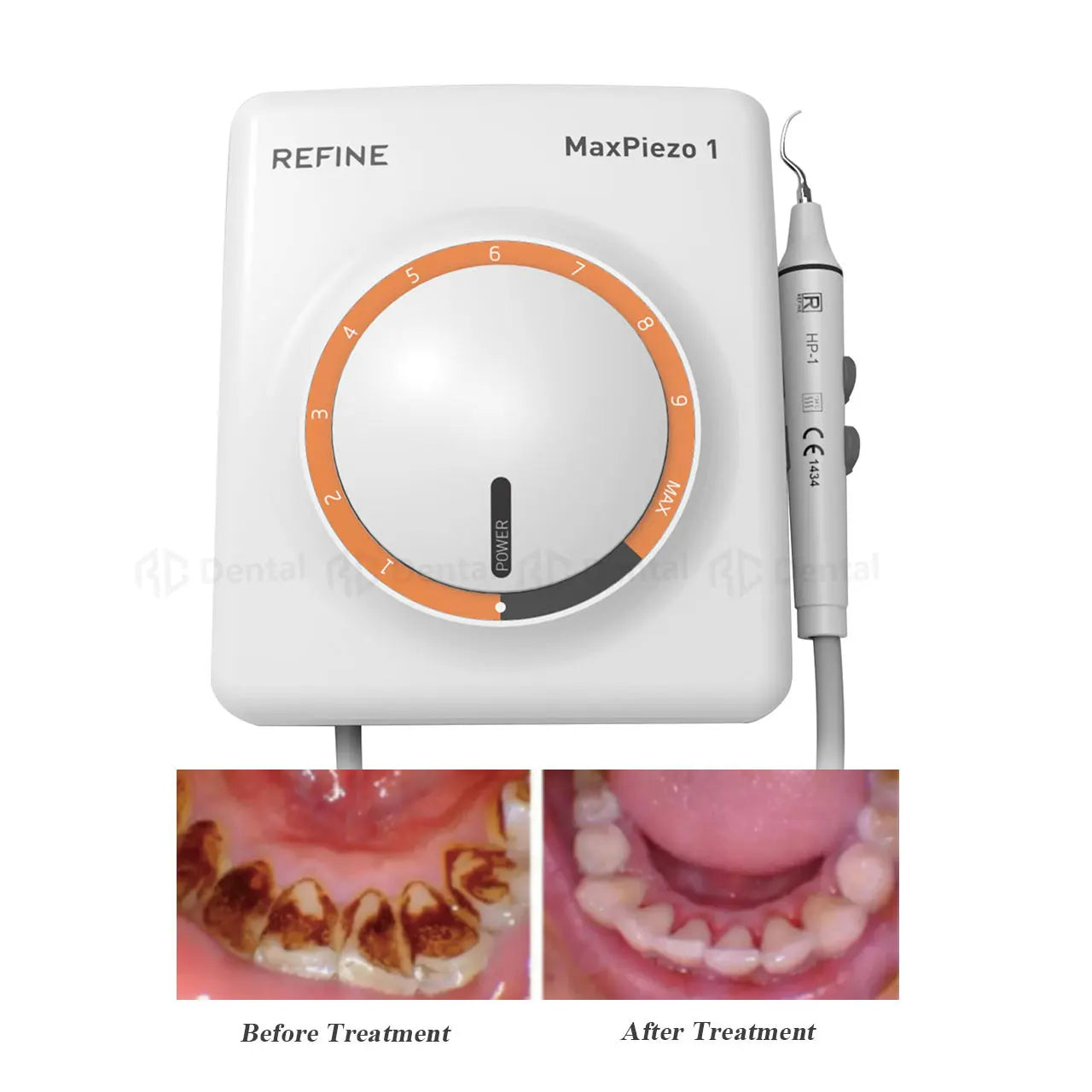 Dental Ultrasonic Calculus Scaler Oral Teeth Tartar Remover Plaque Stains Cleaner Removal Teeth Whitening Refine MaxPiezo 1