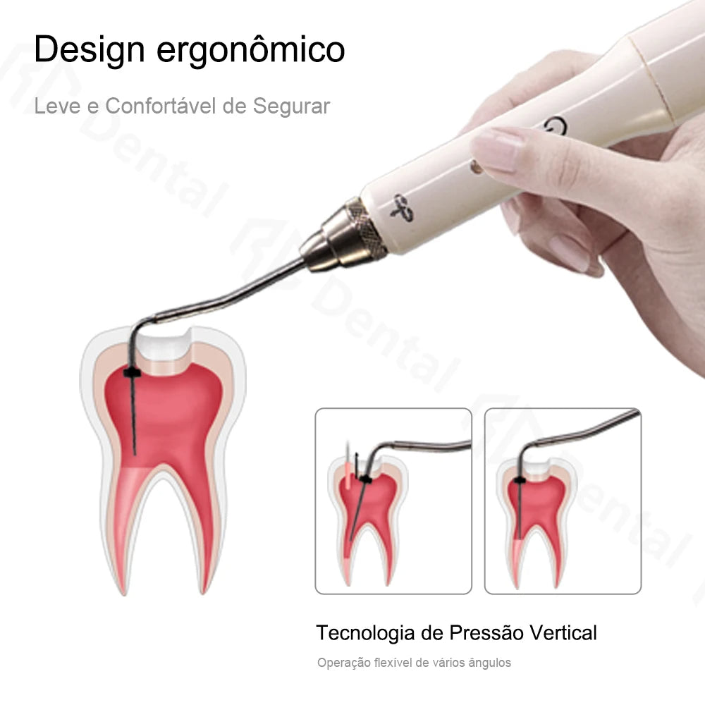 Dental Cordless Wireless Gutta Percha Obturation System Endo Heated Pen+ 2 Tips US EU Plug 220V 110V