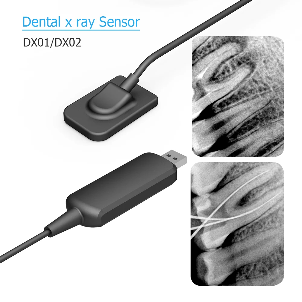 Dental x-ray Sensor DynImage Fast Transmission Digital Intraoral System Intra-Oral with Software 3m Cable Clear Image DynImage