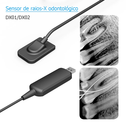 Dental x-ray Sensor DynImage Fast Transmission Digital Intraoral System Intra-Oral with Software 3m Cable Clear Image DynImage