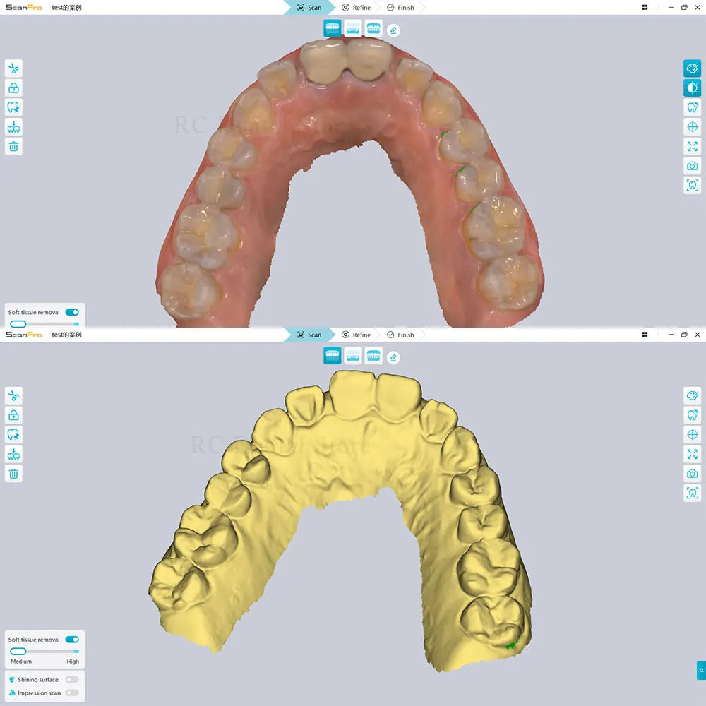 Varredor intraoral digital do sensor 3d do varredor dental com software cor real cad cam cadeira sistema lateral digitalização rápida usb