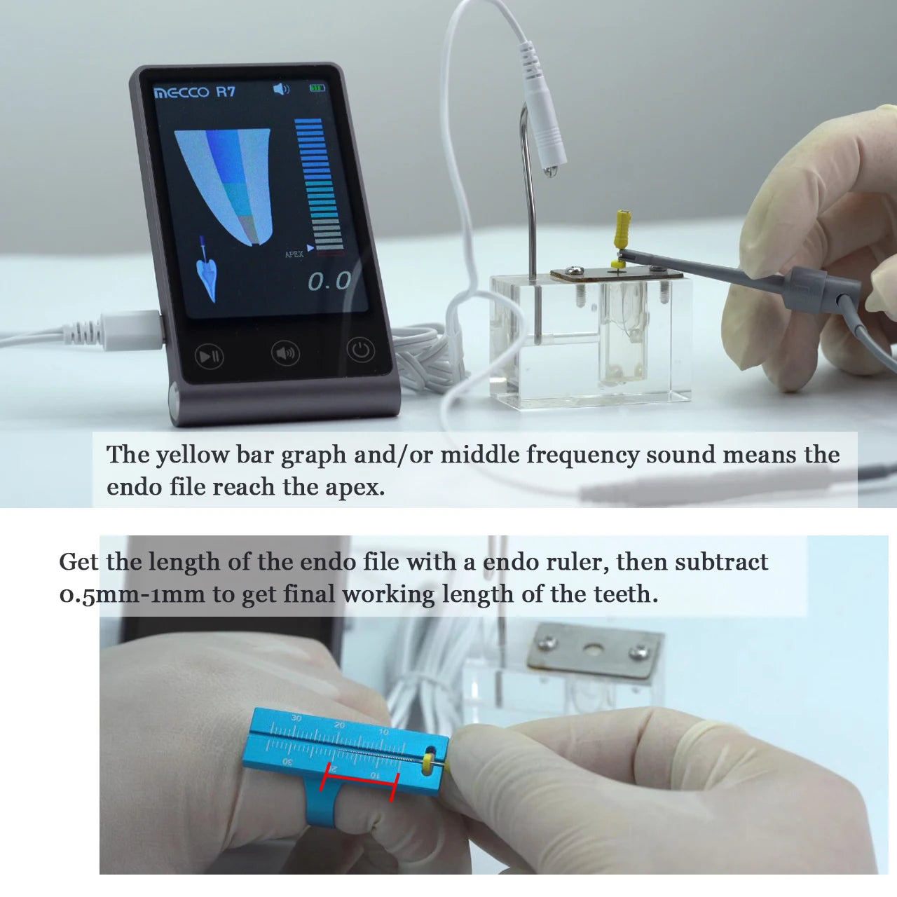 Dental Endodontic Apex Locator Micropex Mini Root Canal Measurement 3.7' LCD Portable Machine Oral Endo Surgical Instruments a7 r7