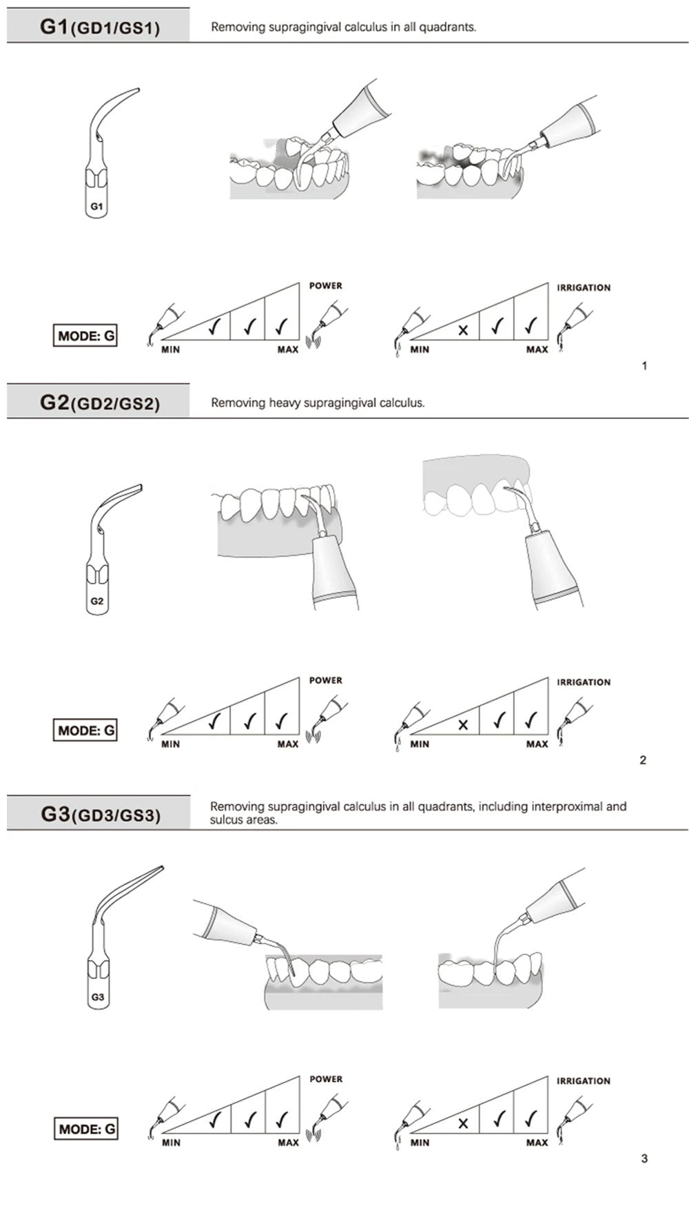 For EMS Woodpecker Refine Ultrasonic Scaler Handpiece Scaling Tip Dental Supragingival Scaler Tips G1 G2 G4 P1