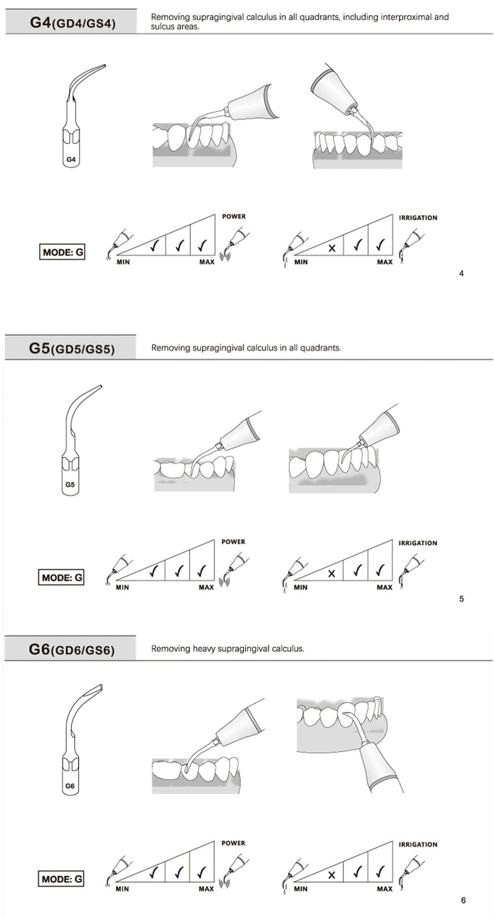 For EMS Woodpecker Refine Ultrasonic Scaler Handpiece Scaling Tip Dental Supragingival Scaler Tips G1 G2 G4 P1